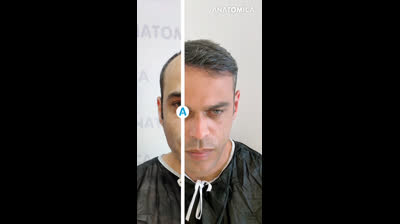 The Ultimate Destination for Hair Restoration?